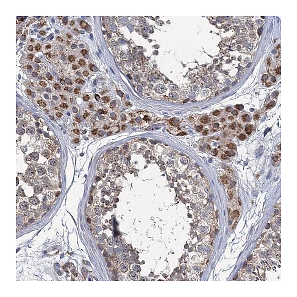 Merck Anti-METTL4 antibody produced in rabbit