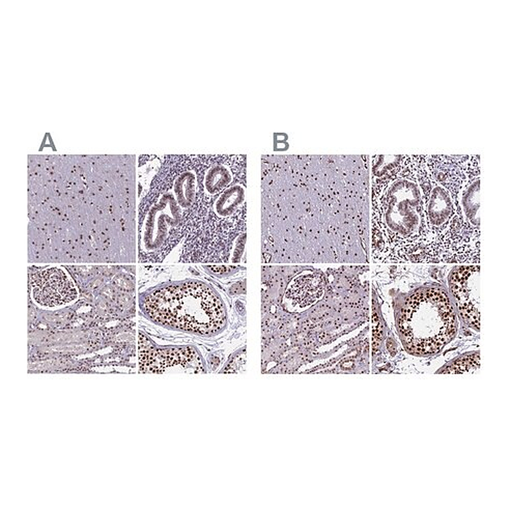 Merck Anti-MPHOSPH8 antibody produced in rabbit