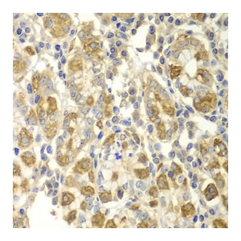 Merck ANTI-TNF-? ANTIBODY PRODUCED IN RABBIT
