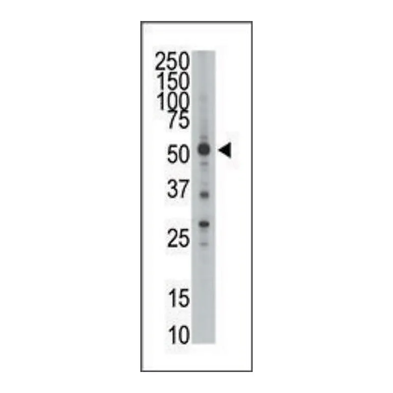 Merck Anti-HtrA1 (N-term) antibody produced in rabbit