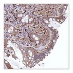 Merck ANTI-LINC00470