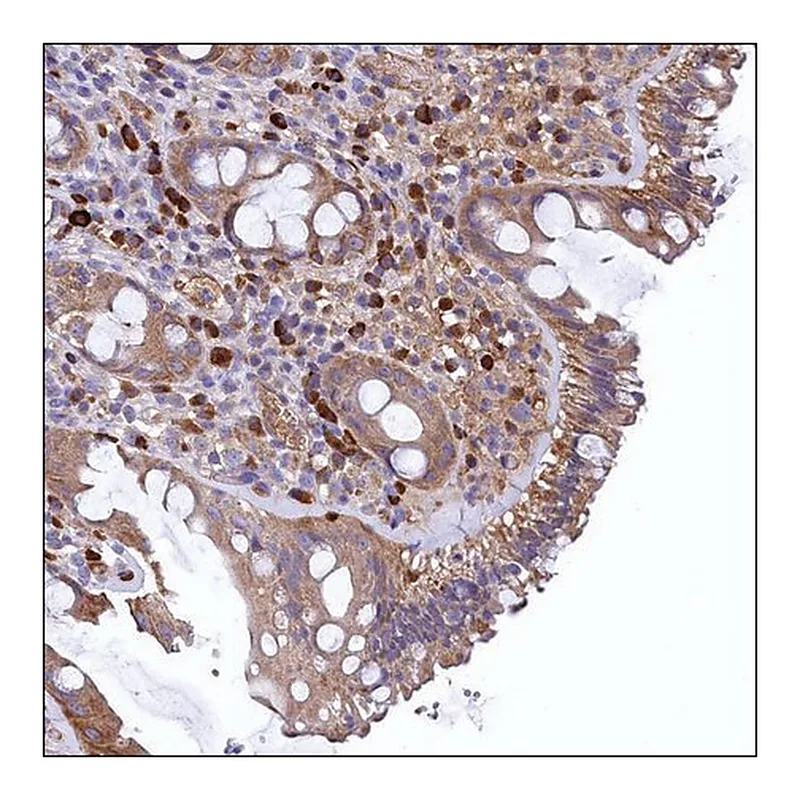 Merck ANTI-LINC00470