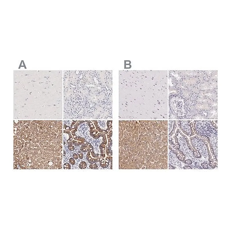 Merck Anti-OTC antibody produced in rabbit