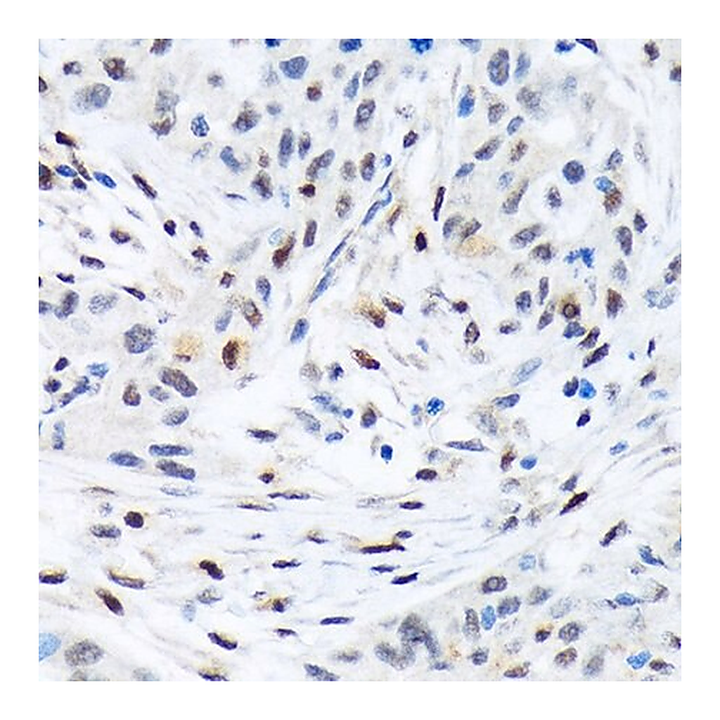 Merck Anti-TFE3 antibody produced in rabbit