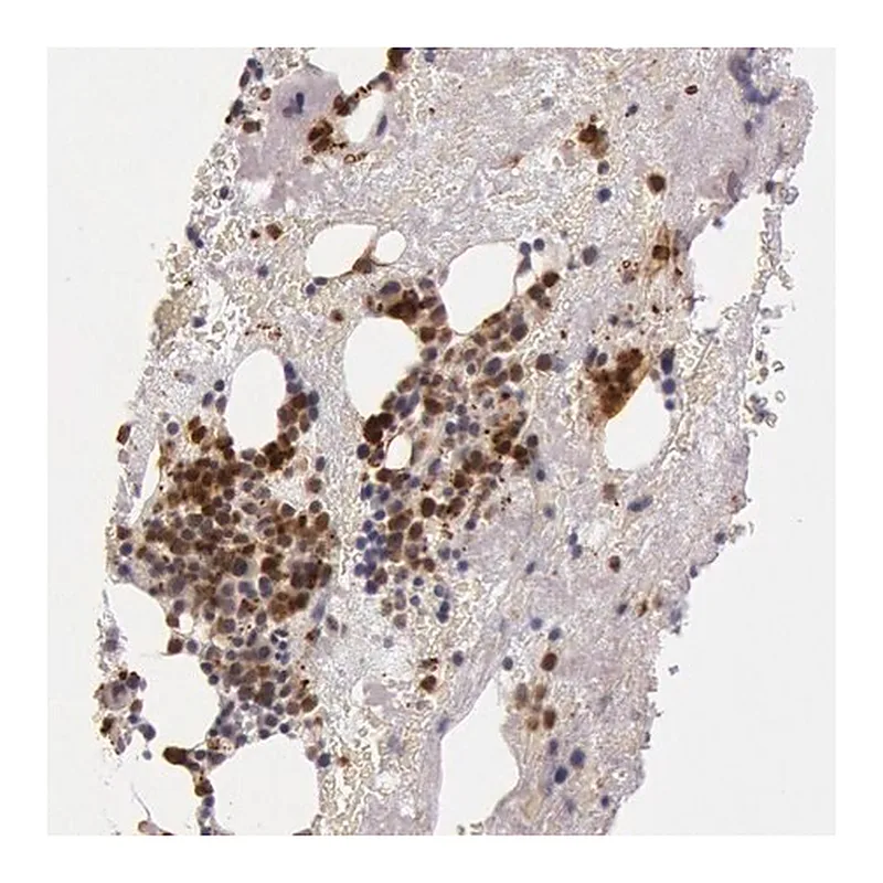 Merck Anti-KDM6A antibody produced in rabbit