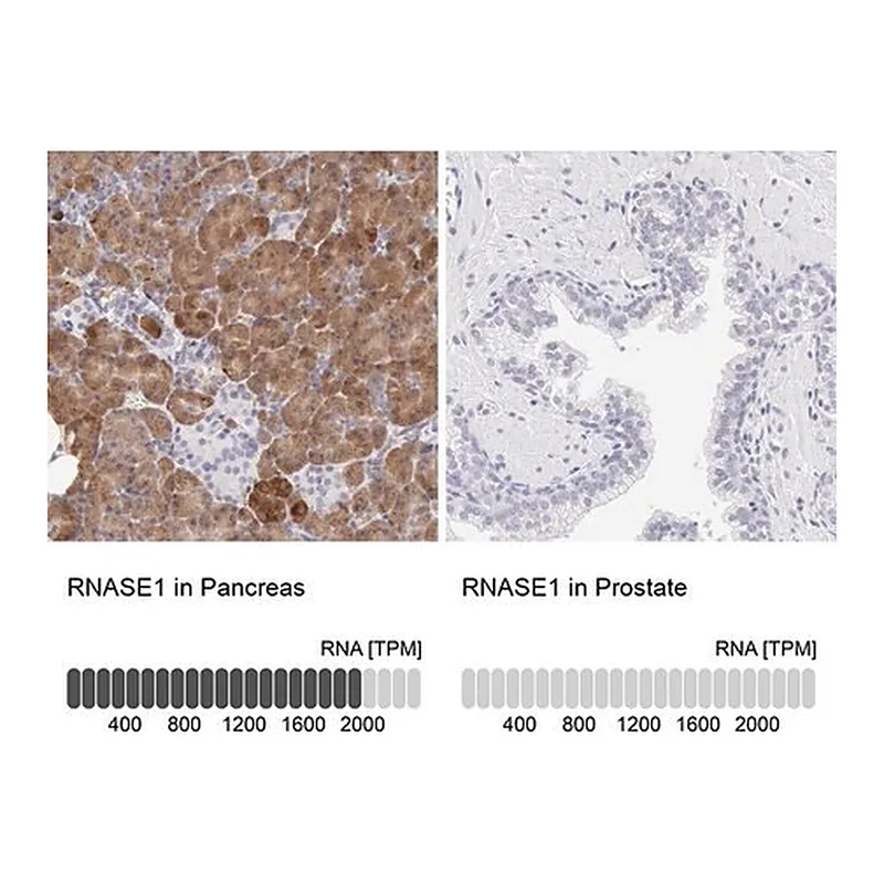Merck Anti-RNASE1 antibody produced in rabbit