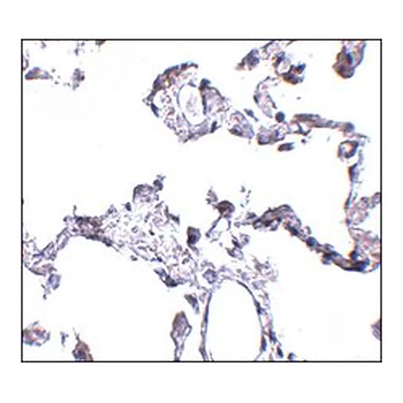 Merck ANTI-CD81