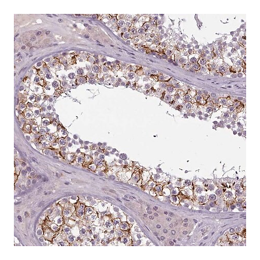Merck Anti-PBX4 antibody produced in rabbit