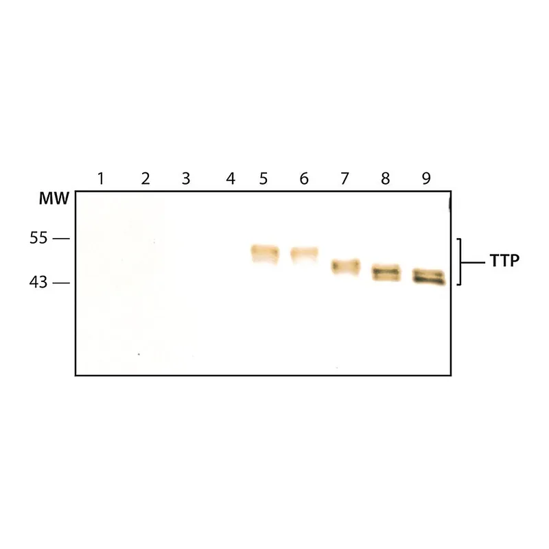 Merck Anti-TTP (N-terminal) antibody produced in rabbit