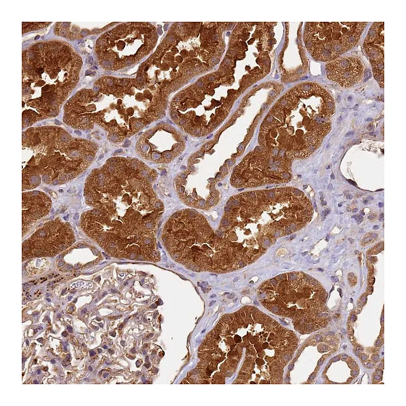 Atlas Antibodies Anti-SCGB2B2 Antibody