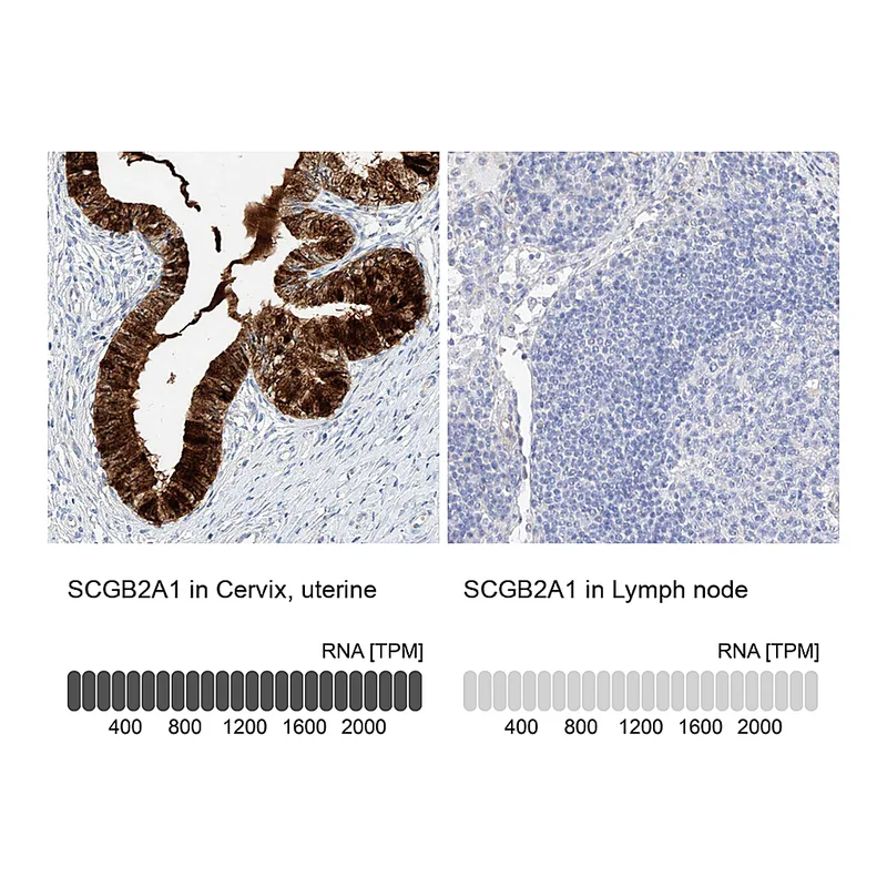 Atlas Antibodies Anti-SCGB2A1 Antibody