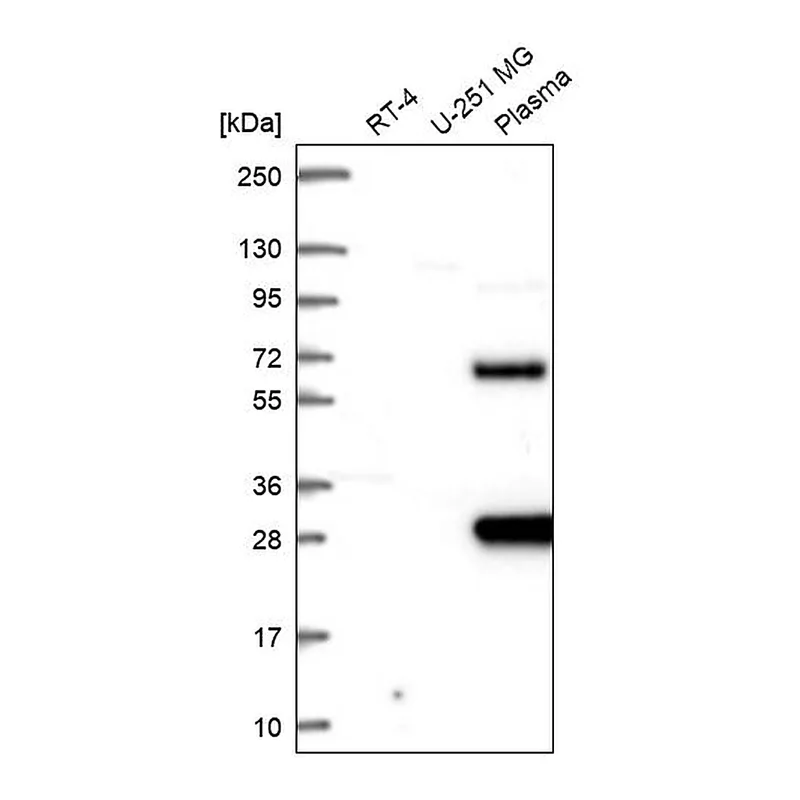 Atlas Antibodies Anti-SCHIP1 Antibody