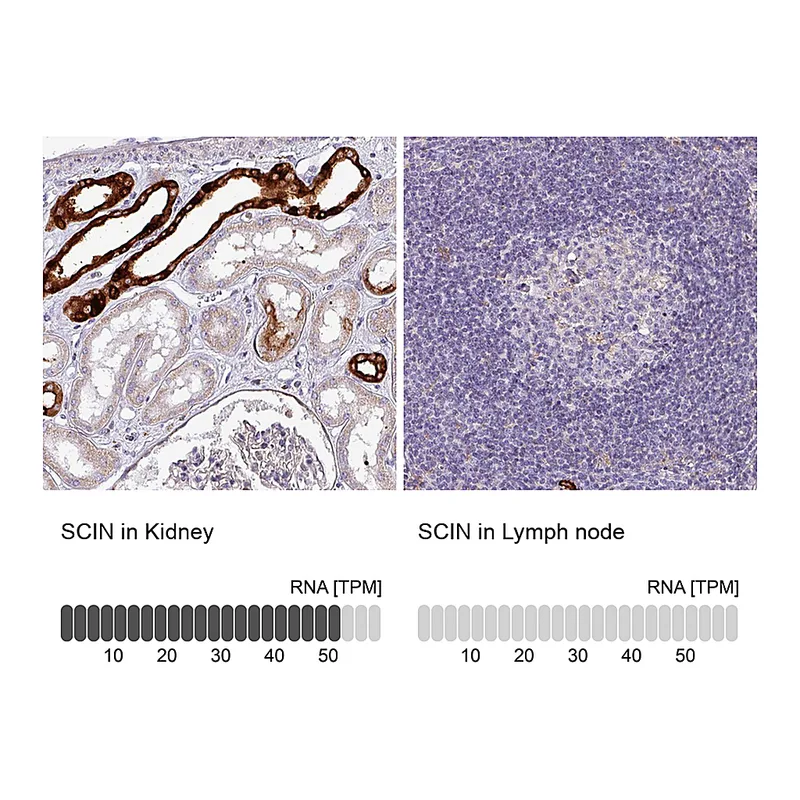 Atlas Antibodies Anti-SCIN Antibody