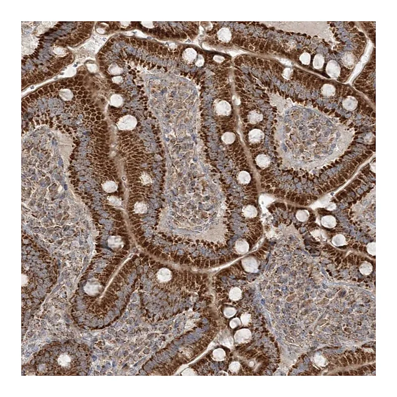 Atlas Antibodies Anti-SCLT1 Antibody