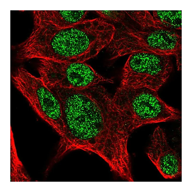 Atlas Antibodies Anti-SCMH1 Antibody