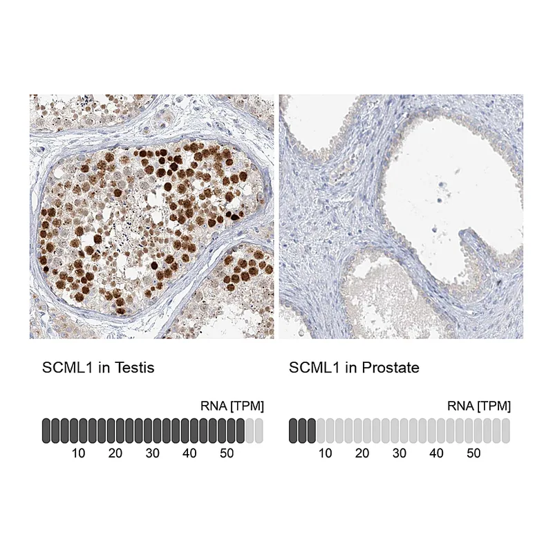 Atlas Antibodies Anti-SCML1 Antibody