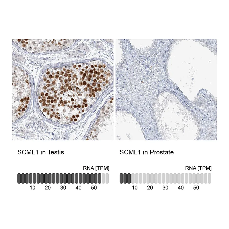 Atlas Antibodies Anti-SCML1 Antibody