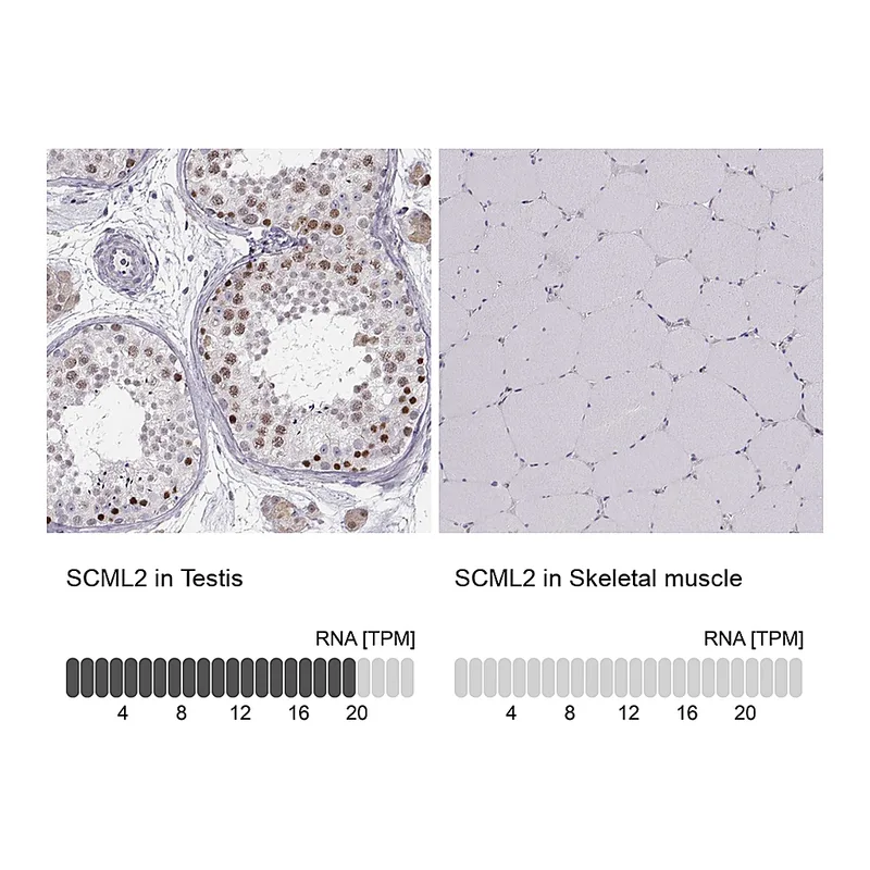 Atlas Antibodies Anti-SCML2 Antibody