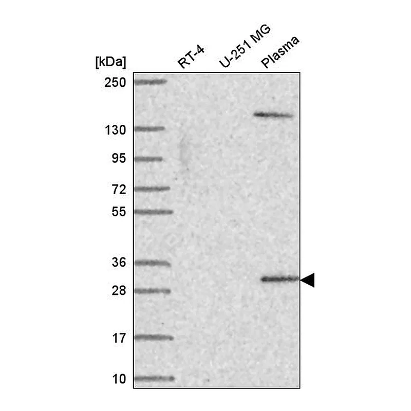Atlas Antibodies Anti-SCML1 Antibody
