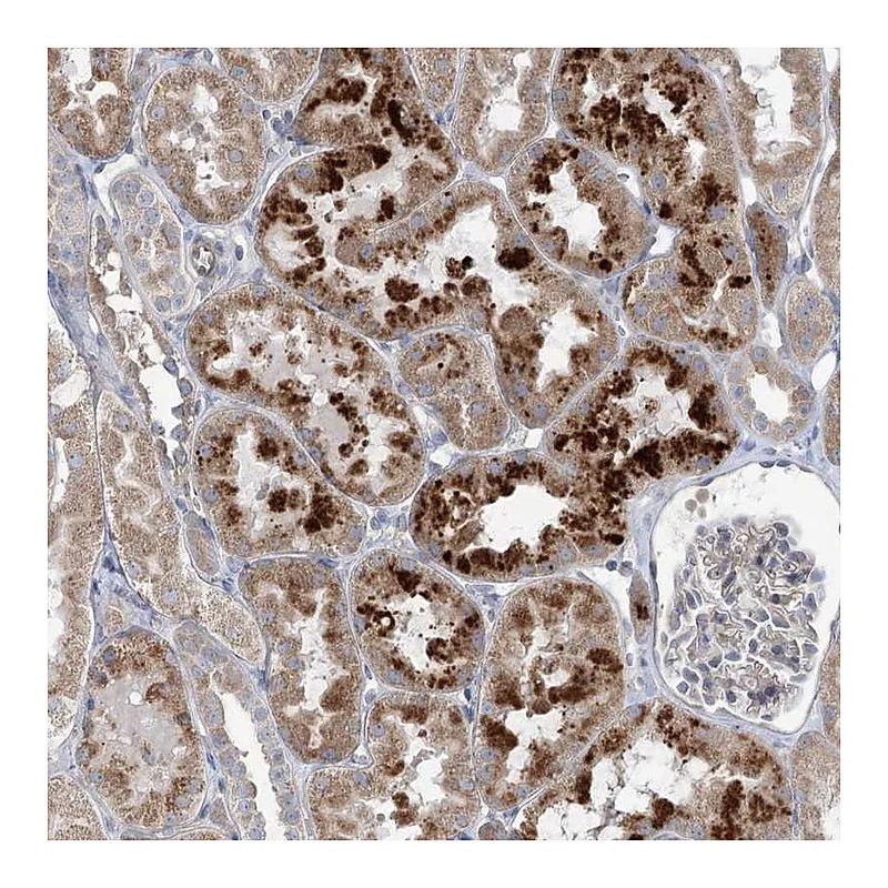 Atlas Antibodies Anti-SCN11A Antibody