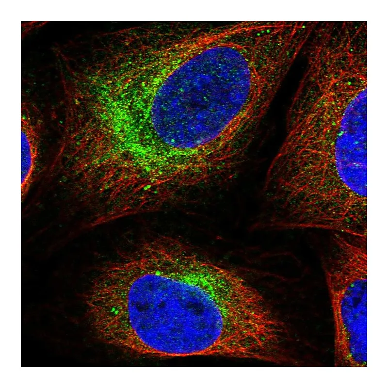 Atlas Antibodies Anti-SCN3B Antibody