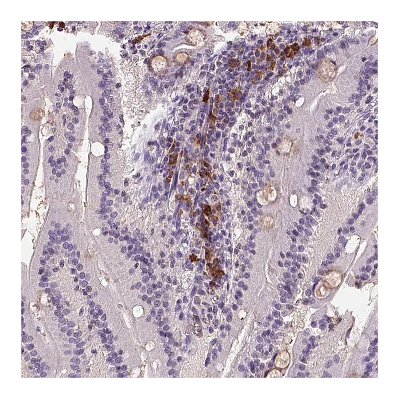 Atlas Antibodies Anti-SCML4 Antibody