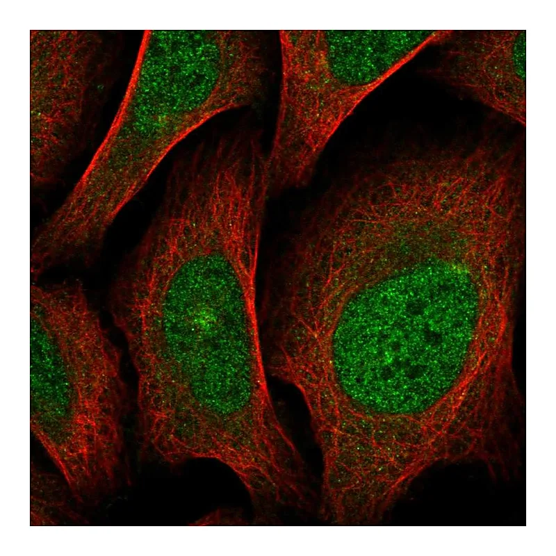 Atlas Antibodies Anti-SCN4A Antibody