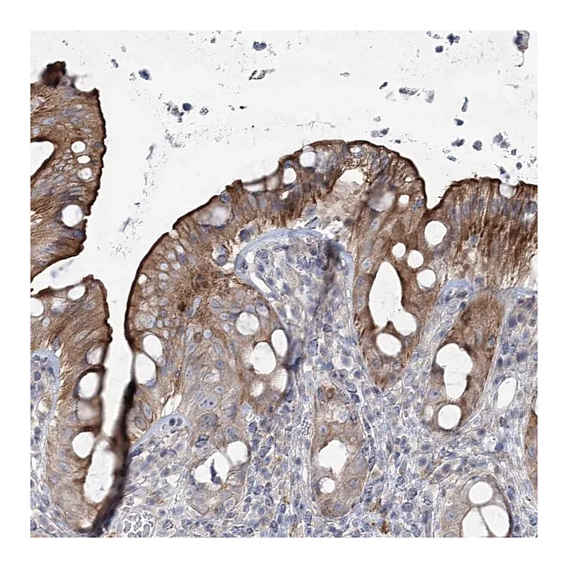 Atlas Antibodies Anti-SCN11A Antibody