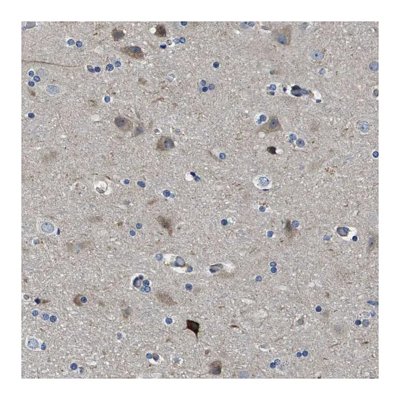 Atlas Antibodies Anti-SCN4B Antibody