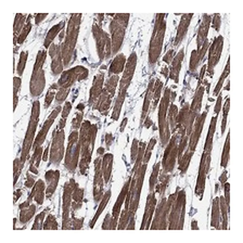 Atlas Antibodies Anti-SCN7A Antibody
