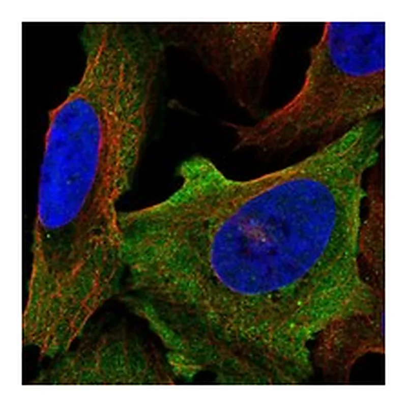 Atlas Antibodies Anti-SCN8A Antibody