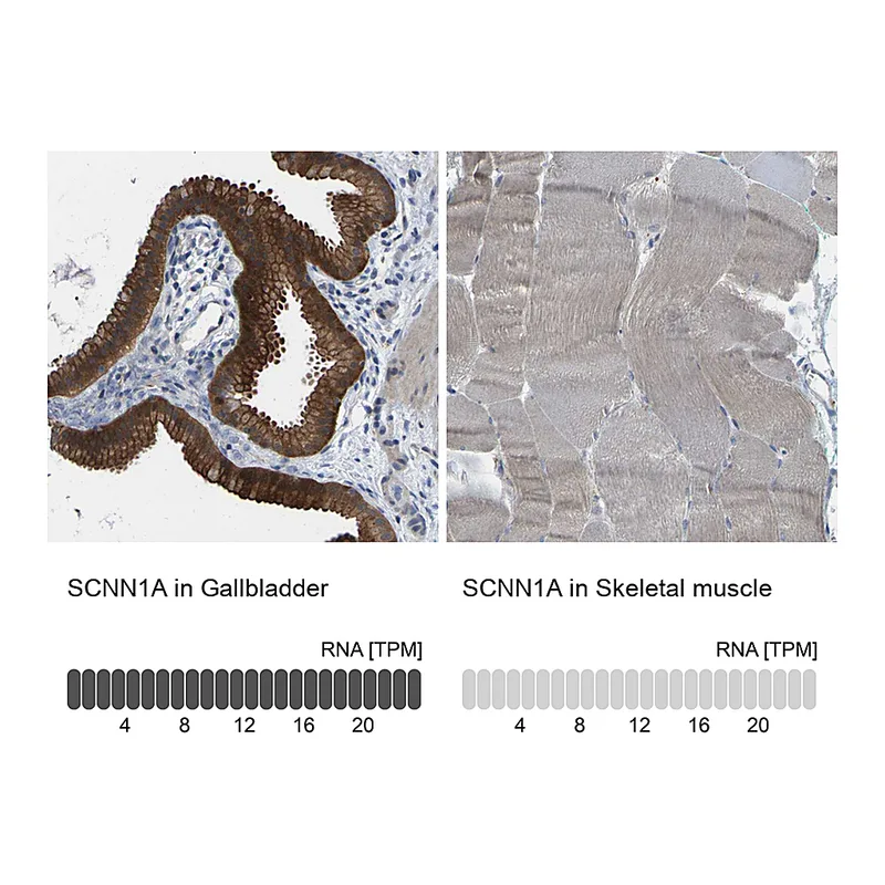 Atlas Antibodies Anti-SCNN1A Antibody