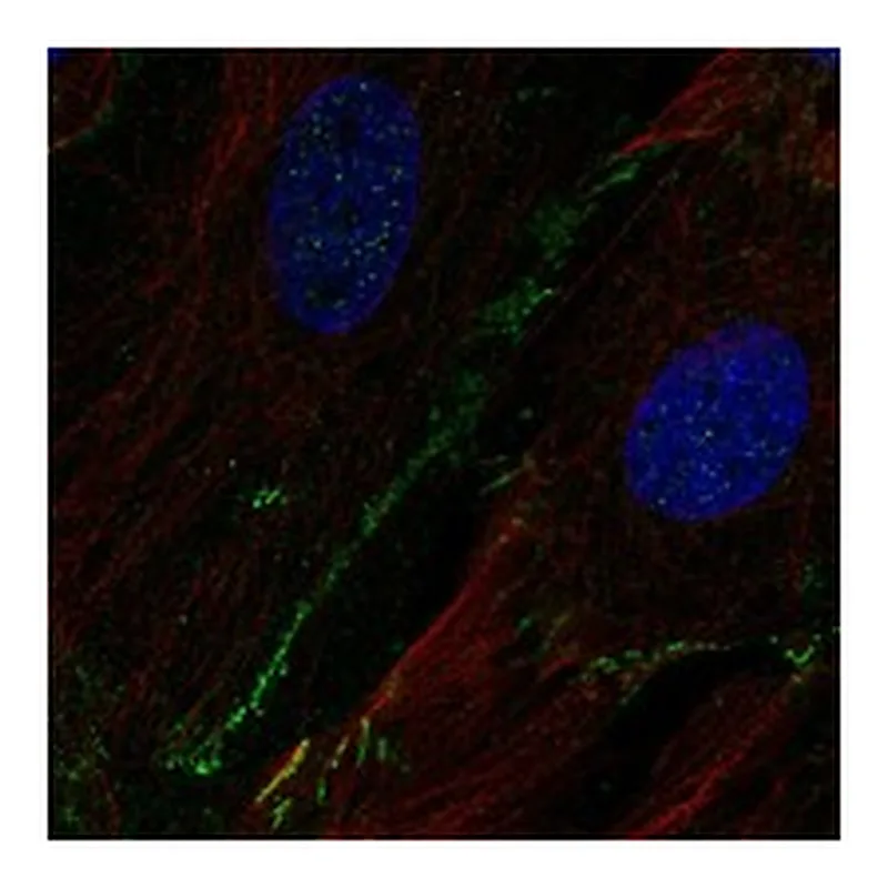 Atlas Antibodies Anti-SCN8A Antibody