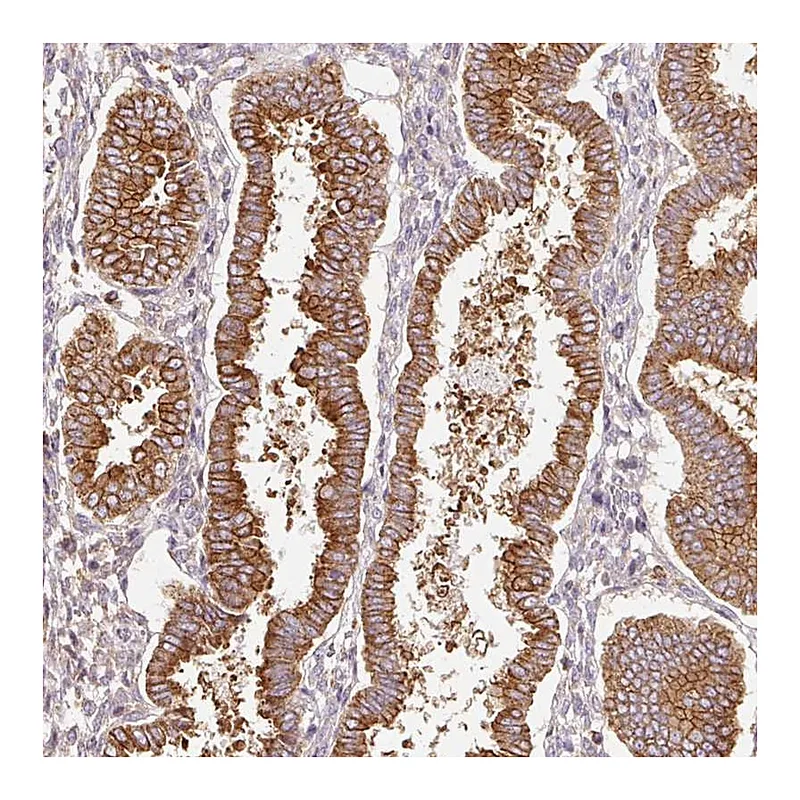 Atlas Antibodies Anti-SCNM1 Antibody