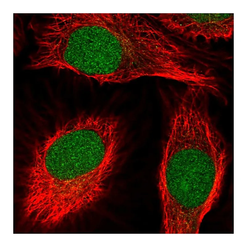 Atlas Antibodies Anti-SCNM1 Antibody