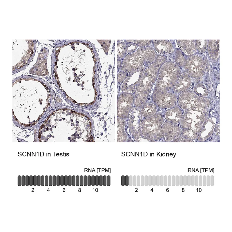 Atlas Antibodies Anti-SCNN1D Antibody