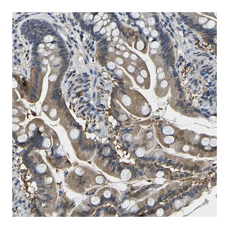 Atlas Antibodies Anti-SCNN1B Antibody