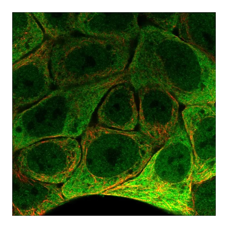 Atlas Antibodies Anti-SCNN1G Antibody