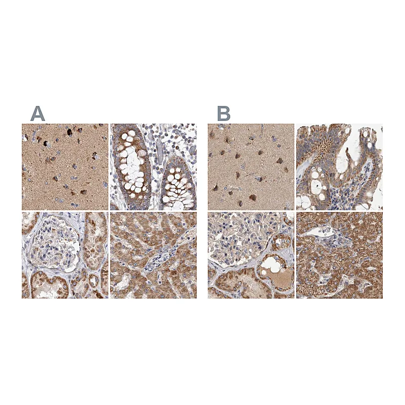 Atlas Antibodies Anti-SCO1 Antibody