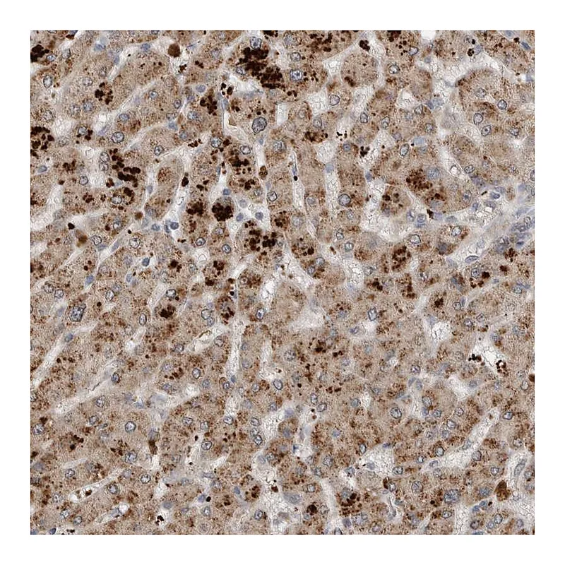 Atlas Antibodies Anti-SCP2 Antibody