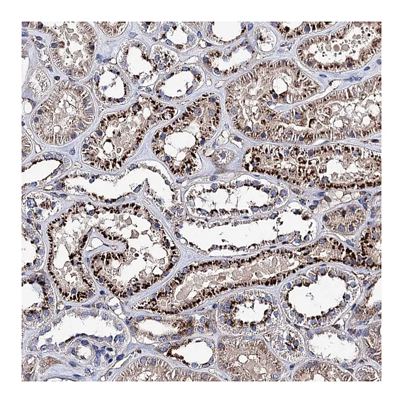 Atlas Antibodies Anti-SCPEP1 Antibody