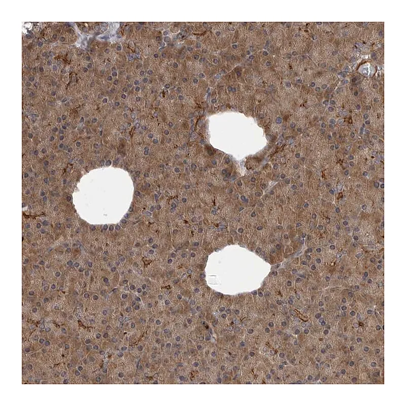 Atlas Antibodies Anti-SCP2 Antibody