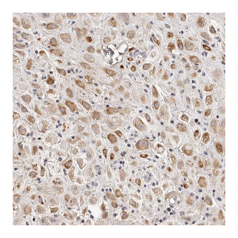 Atlas Antibodies Anti-SCUBE2 Antibody