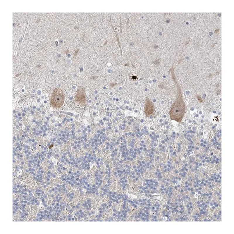 Atlas Antibodies Anti-SDAD1 Antibody