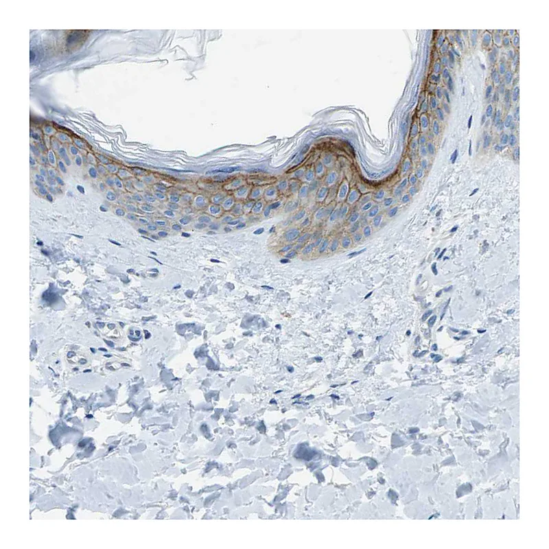 Atlas Antibodies Anti-SDC1 Antibody
