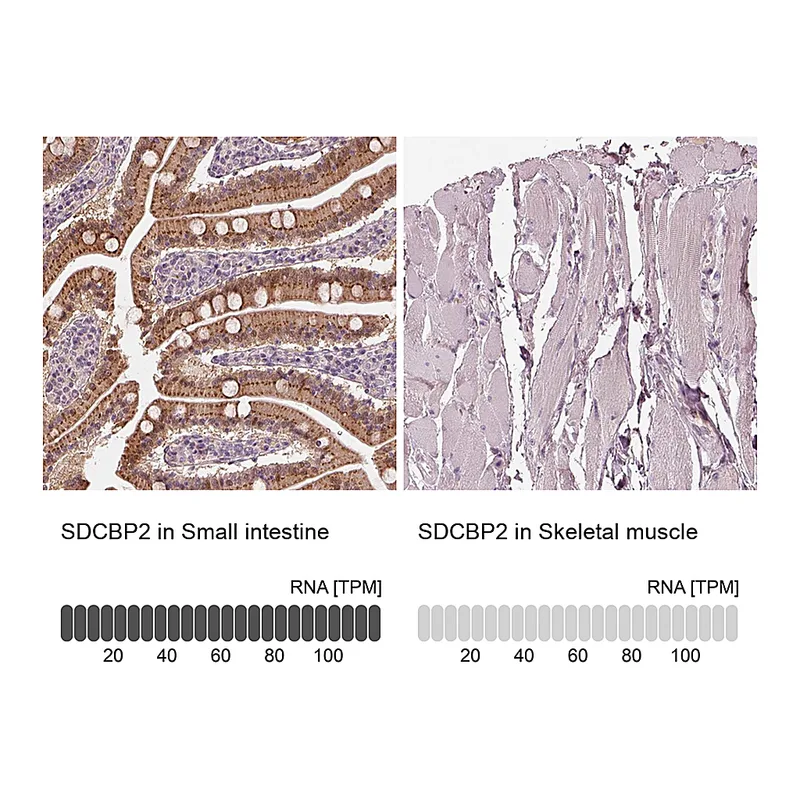 Atlas Antibodies Anti-SDCBP2 Antibody