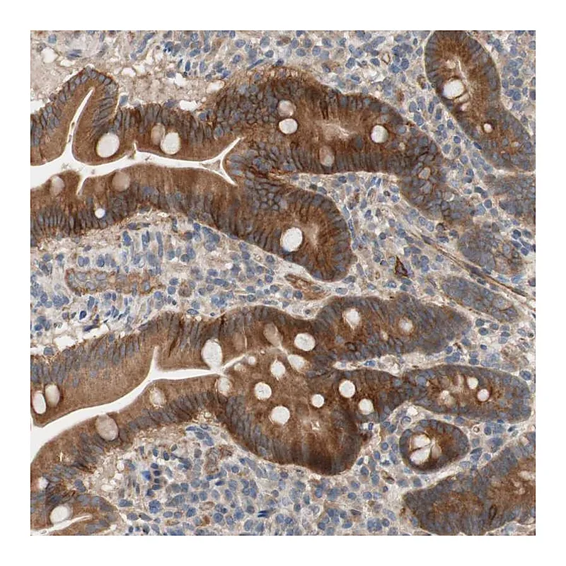 Atlas Antibodies Anti-SDC4 Antibody