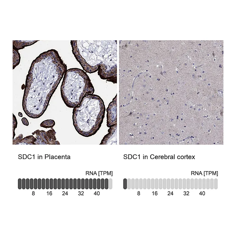 Atlas Antibodies Anti-SDC1 Antibody