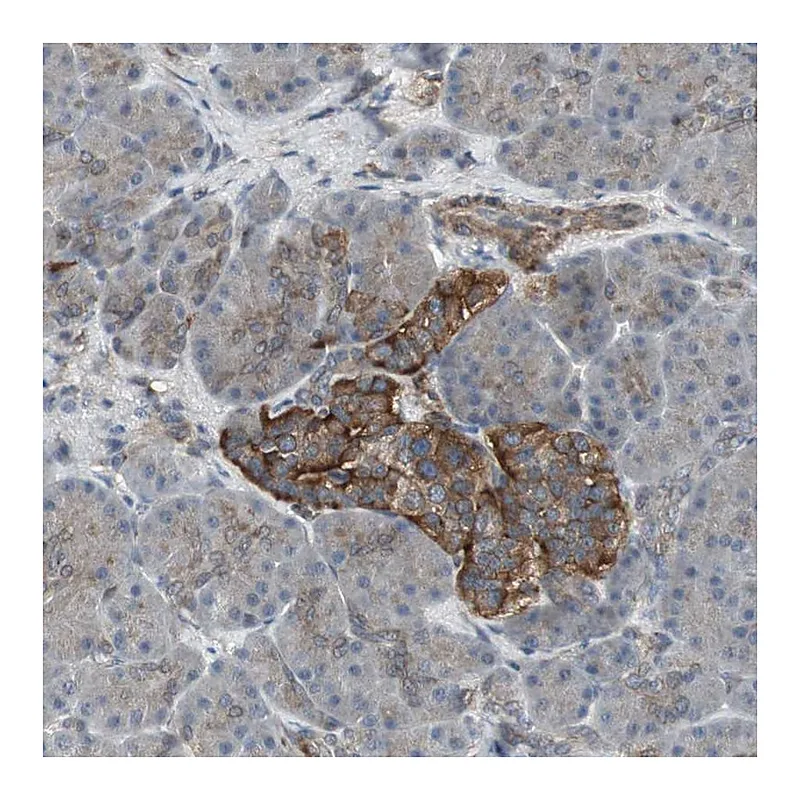 Atlas Antibodies Anti-SCYL3 Antibody