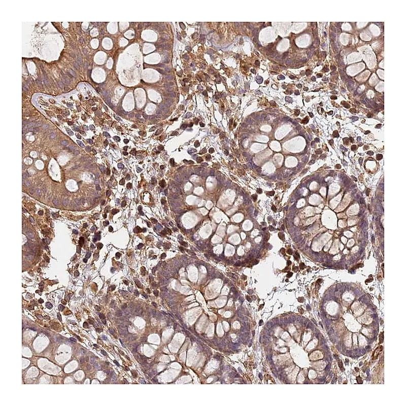 Atlas Antibodies Anti-SDCCAG8 Antibody
